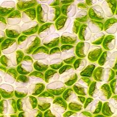 Ulva - cells with cup shaped chloroplasts and prominent pyrenoid