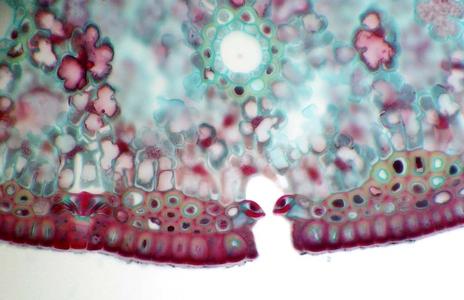 Stoma in cross section of pine leaf