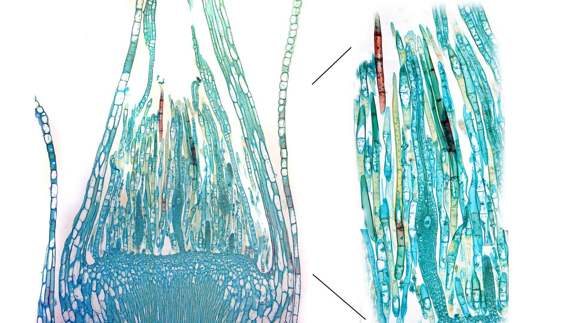 Архегоний мха под микроскопом