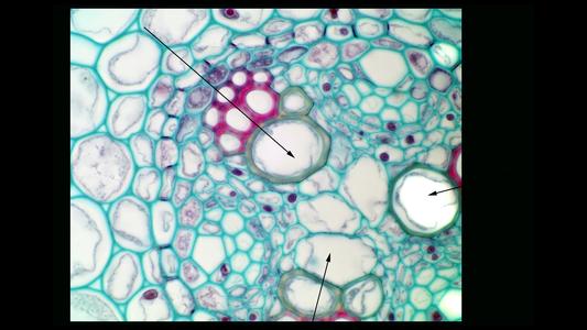 Procambium in the center of the vascular cylinder seen in cross section of an immature Ranunculus root