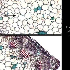 Cross section of Medicago stem - composite of images