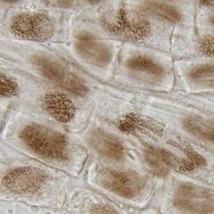 Anaphase, prophase and telophase cells from a Narcissus root squash