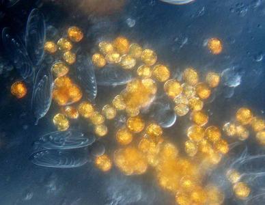 Zooxanthellae  with nematocysts of macerated pancake anemone tissue 60x objective DIC illumination