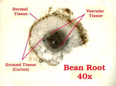 Cross section of bean seedling root labeled