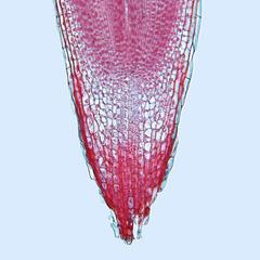 Ranunculus root - longitudinal section of root tip