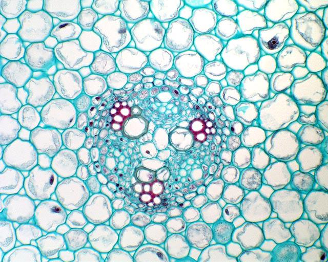 ‎Vascular cylinder seen in cross section of a immature Ranunculus root UWDC UWMadison Libraries