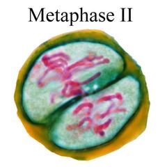 Metaphase II - Lilium microsporogenesis