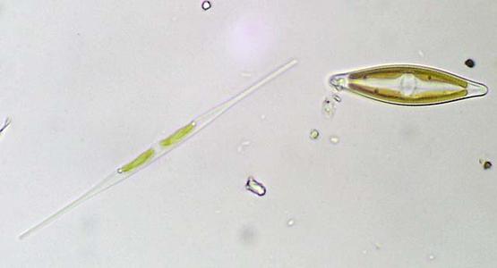 Diatoms - Nitzschia and Pennularia, pennate diatoms