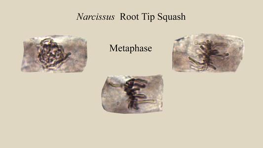 Various metaphase cells from a Narcissus root squash