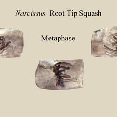 Various metaphase cells from a Narcissus root squash