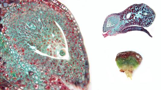 Ovunle, seed scale complex in longitudinal section, and dissected seed scale showing two ovules