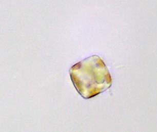 Girdle view of a living centric diatom