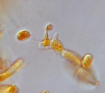 Cedar apple rust - germinating teliospores from infection on cedar view of  basidiospores