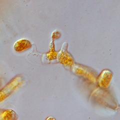 Cedar apple rust - germinating teliospores from infection on cedar view of  basidiospores