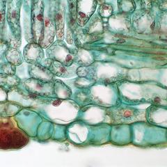 Lower epidermis with a peltate trichome seen in cross section of a lilac leaf