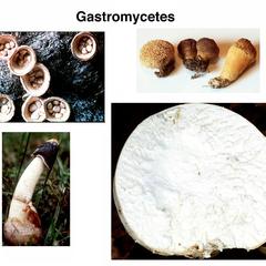 Composite of fruiting bodies of various Gastromycetes