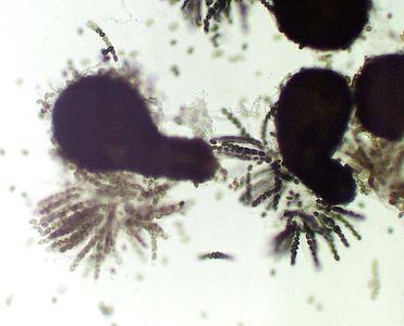 Parathecia of Sordaria crushed to examine asci with ascospores