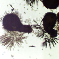 Parathecia of Sordaria crushed to examine asci with ascospores