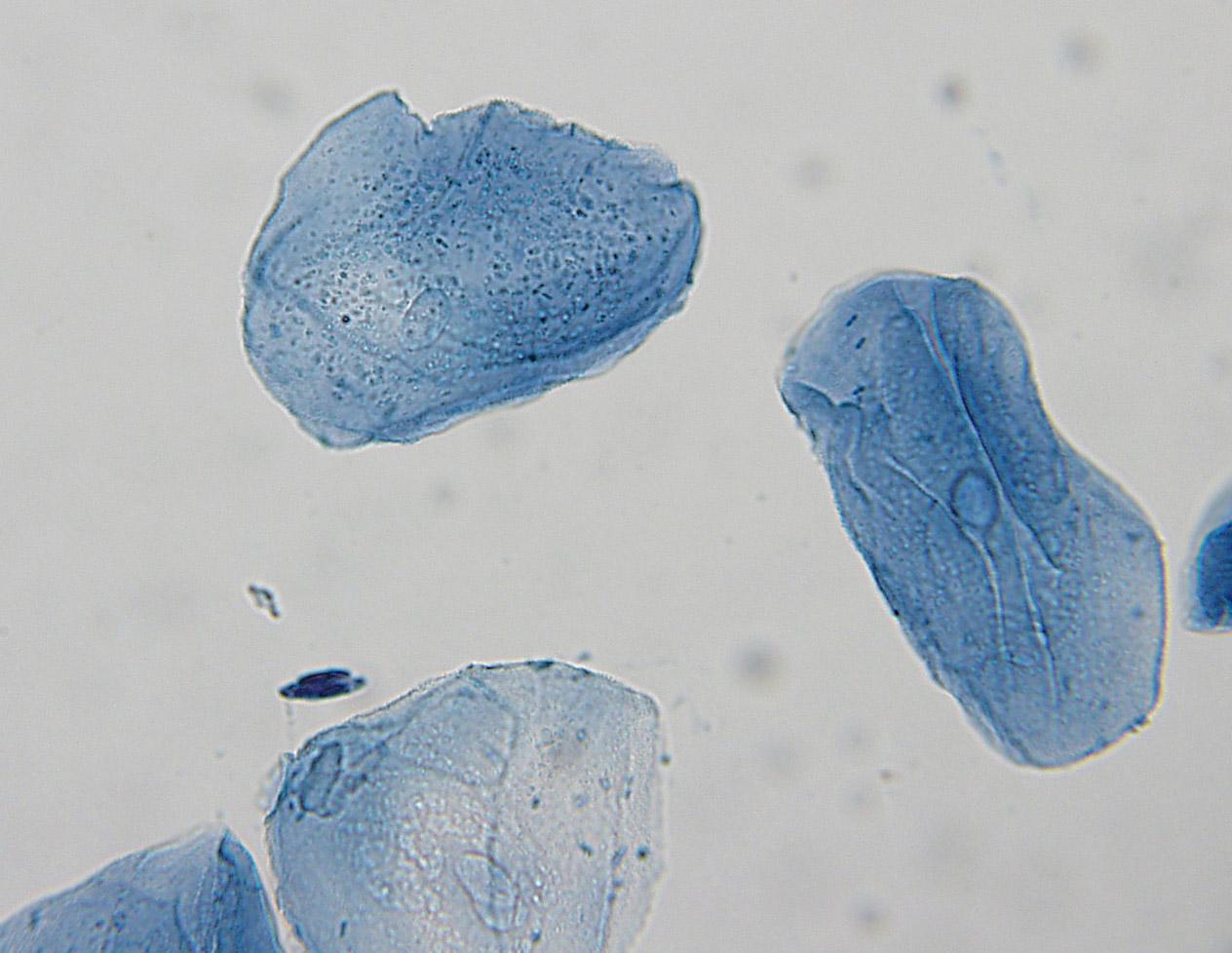 cheek cells under a microscope