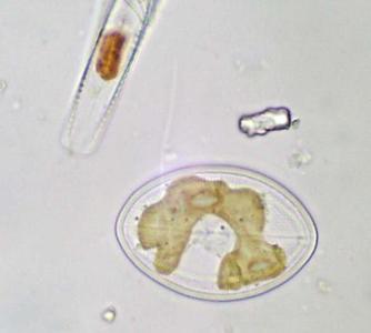 Diatoms - Cocconeis, a pennate diatom
