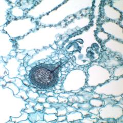 Young sporophyte inside an archegonium of Ricciocarpus - 40x objective