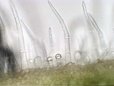 Trichomes- fresh section of Coleus stem bright field illumination