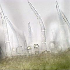 Trichomes- fresh section of Coleus stem bright field illumination