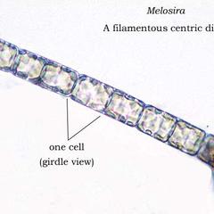 Girdle view of Melosira, a centric diatom