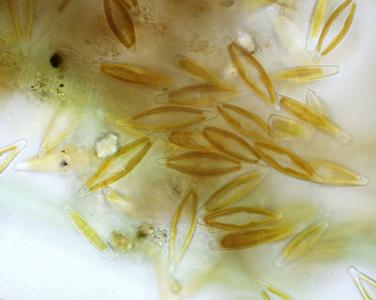 Cluster of motile pennate diatoms
