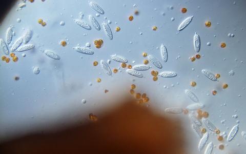 Zooxanthellae with nematocysts of macerated pancake anemone tissue 40x objective