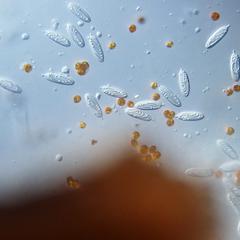 Zooxanthellae with nematocysts of macerated pancake anemone tissue 40x objective