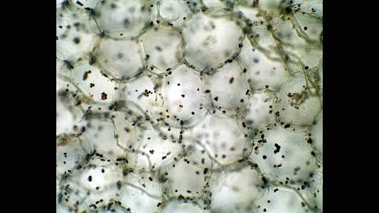 Parenchyma tissue of the pith  stained with iodine