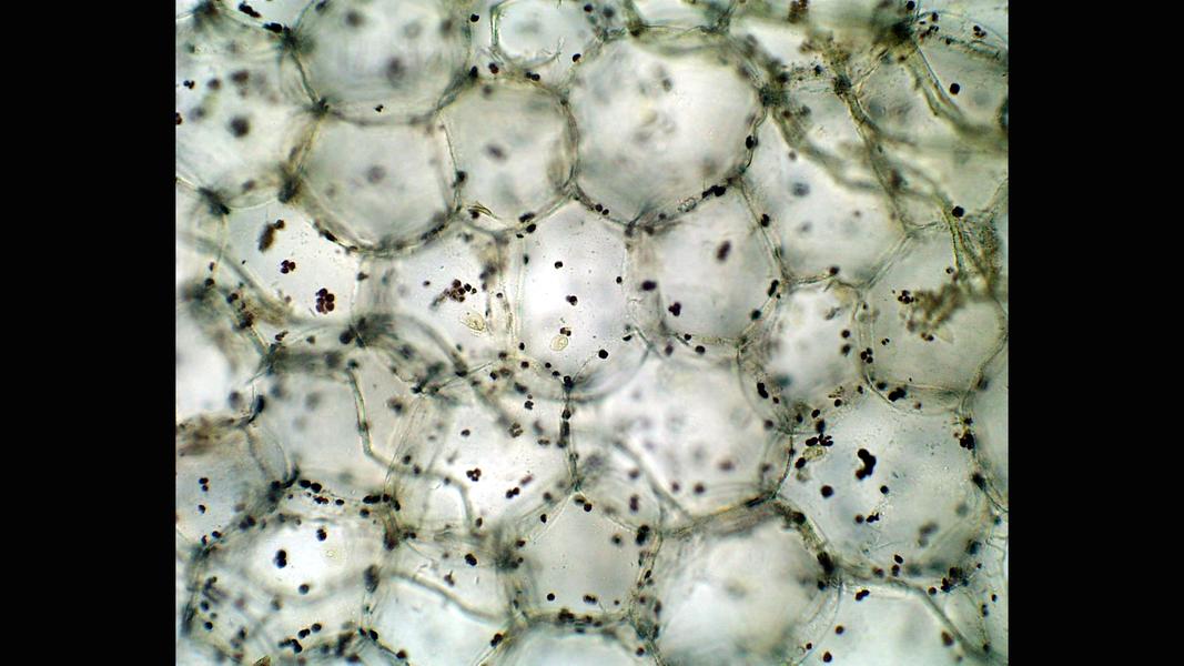 Parenchyma tissue of the pith stained with iodine - UWDC - UW