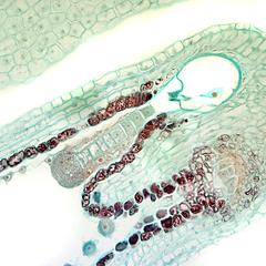 Ovule with globular embryo - detail of the embryo