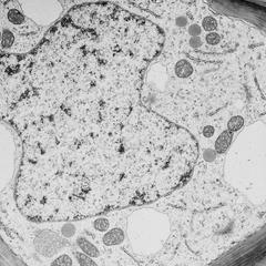 Whole view of a young cell with several vacuoles