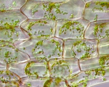 Plasmolyzed cells of Elodea leaf