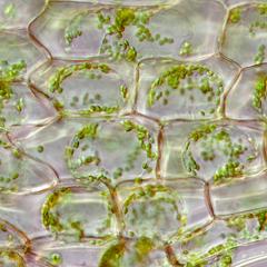 Plasmolyzed cells of Elodea leaf