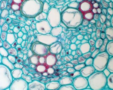 Endodermis and protoxylem pole seen in cross section of a immature Ranunculus root