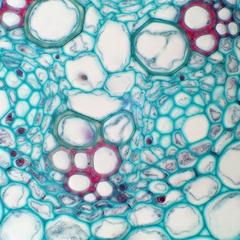Endodermis and protoxylem pole seen in cross section of a immature Ranunculus root