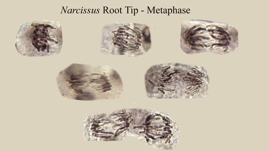 Various anaphase cells from a Narcissus root squash