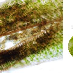 Hornwort - composite of images of the sporophyte : sporangium, tetrad of spores and a stoma