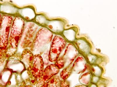 Upper epidermis in cross section of a lilac leaf
