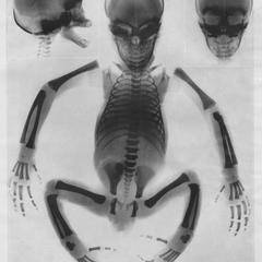 X-Rayed Chimpanzee Fetus
