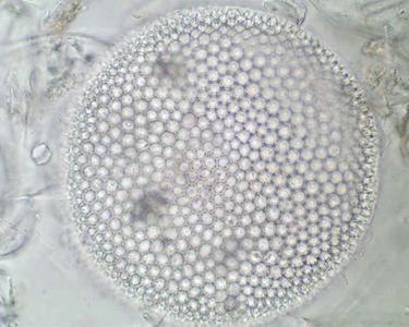 Diatomaceous earth through DIC illumination - valve view of a centric diatom