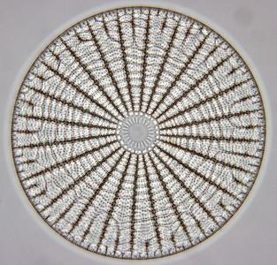 Centric diatom in valve view