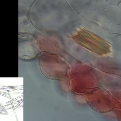 Zebrina leaf tissue with raphides