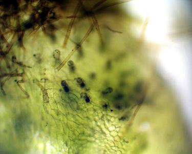 Archegonia embedded in a fern gametophyte with projecting necks