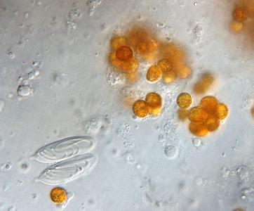Zooxanthellae with nematocysts of macerated pancake anemone tissue 100x objective DIC illumination