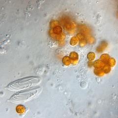 Zooxanthellae with nematocysts of macerated pancake anemone tissue 100x objective DIC illumination
