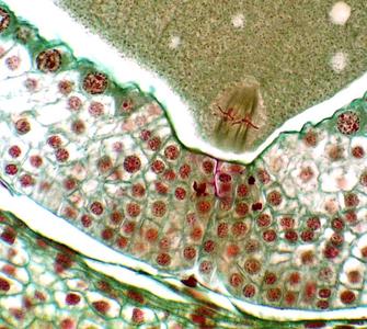 Pine ovule - first mitosis of zygote in metaphase